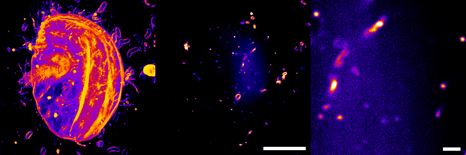 Super-resolution imaging of Colpoda steinii cysts.