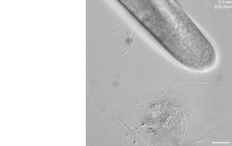 Unknown microorganisms and *Paramecium multimicronucleatum*.